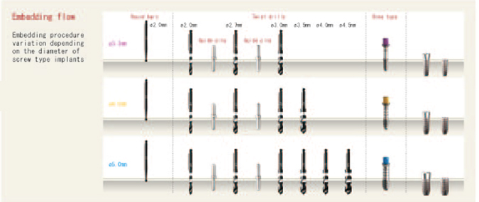 Prosthesis Flow Chart